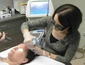 Dr. Irwin performing a fractional CO2 laser resurfacing treatment