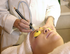 Microdermabrasion and light chemical peels for exfoliation