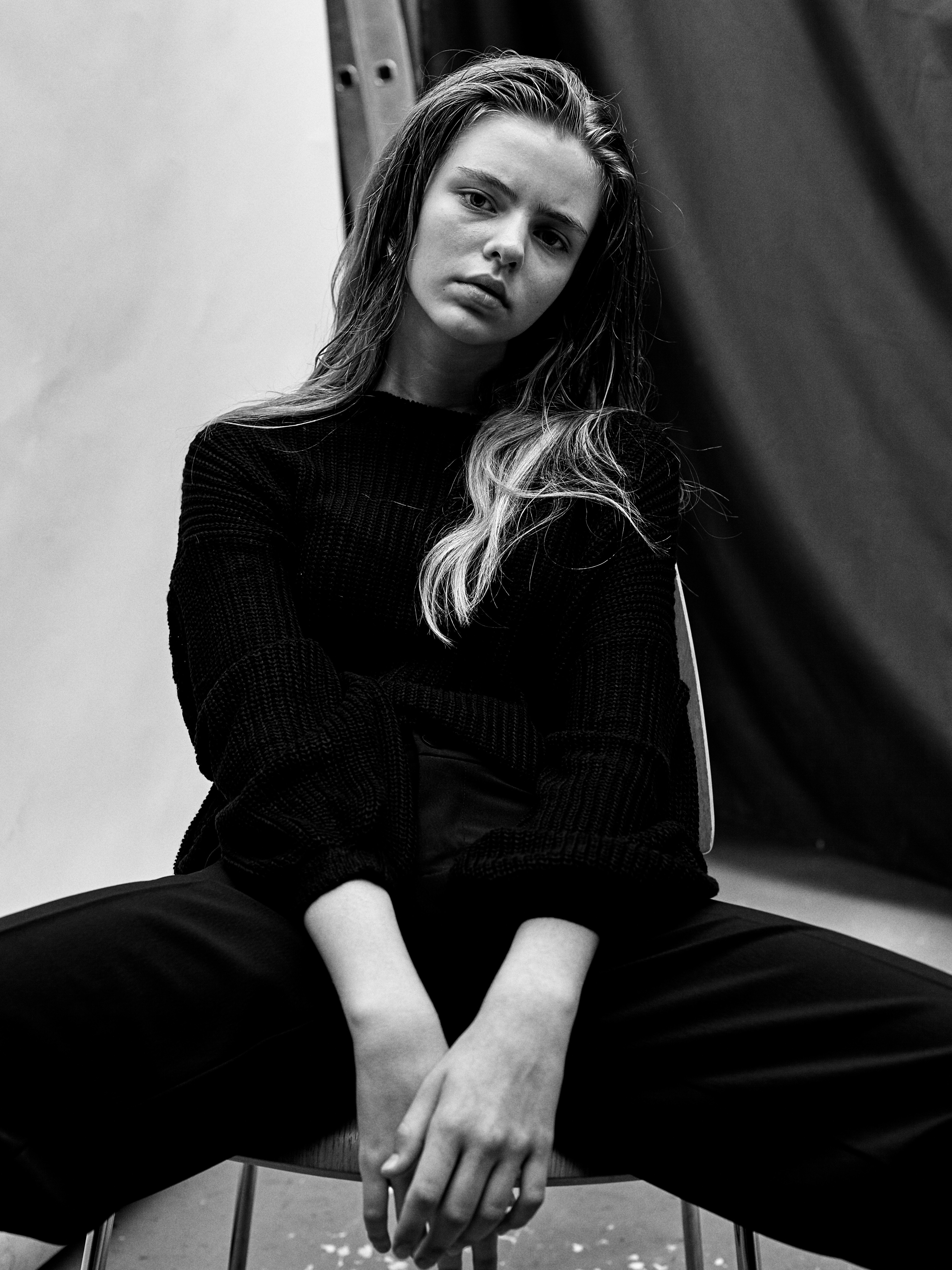 Can you have beautiful skin if you have acne??