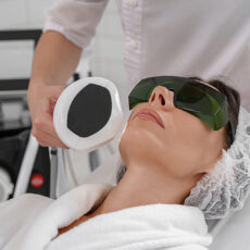 woman getting facial laser treatment